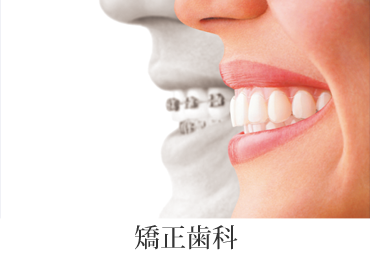 矯正歯科